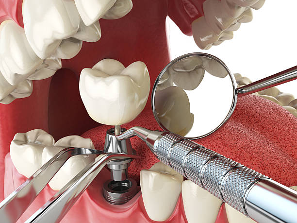 Best Walk-In Emergency Dentist in Santee, SC